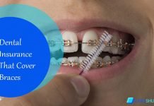 Dental Insurance That Cover Braces Dental Insurance That Cover Braces